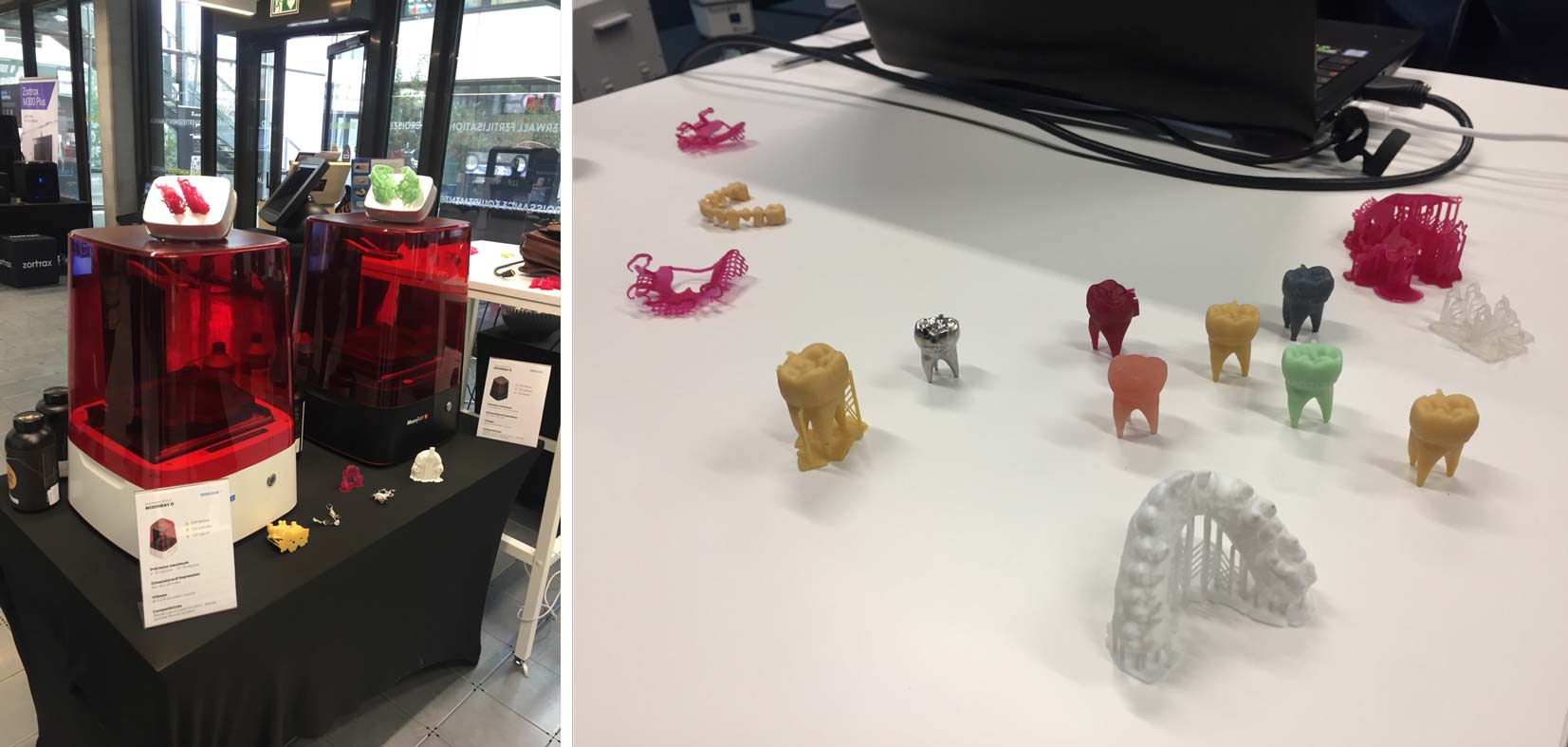 SprintRay 3D printers are ideal for professionals in the dental industry.