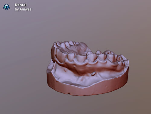 Dental scan