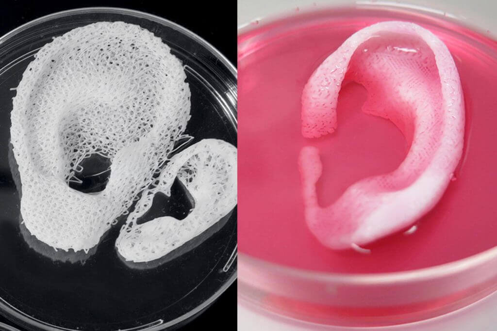 3D printed ear scaffold