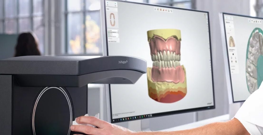 Best dental 3D scanner for labs 3Shape